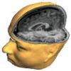 3D cutaway of left hemisphere